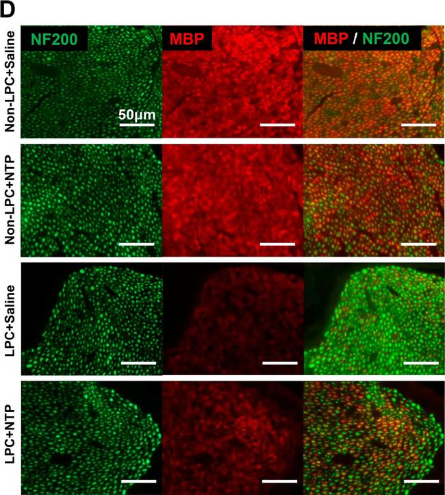 Mouse IgG (H+L) Cross-Adsorbed Secondary Antibody in Immunohistochemistry (IHC)