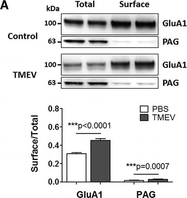 Rabbit IgG (H+L) Secondary Antibody in Western Blot (WB)