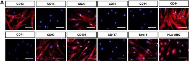 Rabbit IgG (H+L) Cross-Adsorbed Secondary Antibody in Immunocytochemistry (ICC/IF)