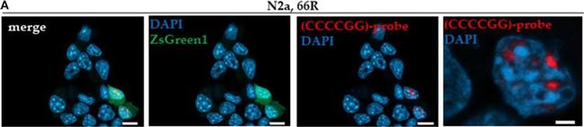 Mouse IgG (H+L) Cross-Adsorbed Secondary Antibody in Immunocytochemistry (ICC/IF)