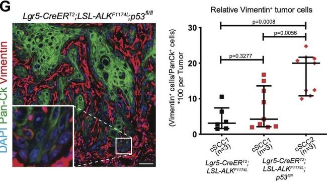 Rabbit IgG (H+L) Cross-Adsorbed Secondary Antibody in Immunohistochemistry (IHC)