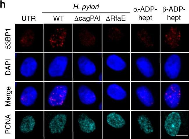 Rabbit IgG (H+L) Highly Cross-Adsorbed Secondary Antibody in Immunocytochemistry (ICC/IF)