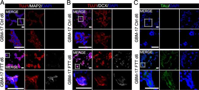 Mouse IgG (H+L) Highly Cross-Adsorbed Secondary Antibody in Immunocytochemistry (ICC/IF)