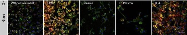 Mouse IgG (H+L) Highly Cross-Adsorbed Secondary Antibody in Immunohistochemistry (Paraffin) (IHC (P))