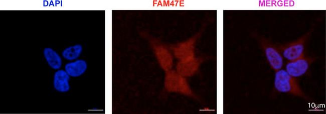 Rabbit IgG (H+L) Cross-Adsorbed Secondary Antibody in Immunocytochemistry (ICC/IF)