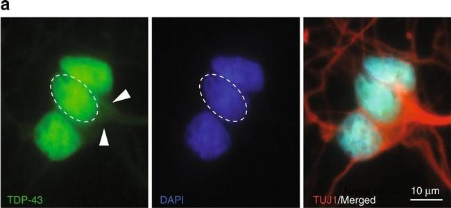 Rabbit IgG (H+L) Highly Cross-Adsorbed Secondary Antibody in Immunocytochemistry (ICC/IF)