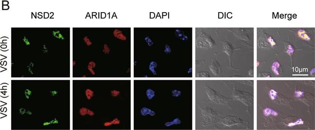 Mouse IgG (H+L) Cross-Adsorbed Secondary Antibody in Immunocytochemistry (ICC/IF)