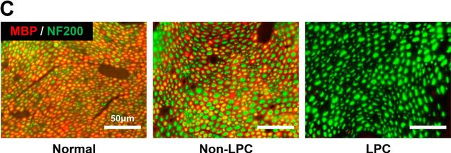 Mouse IgG (H+L) Cross-Adsorbed Secondary Antibody in Immunohistochemistry (IHC)