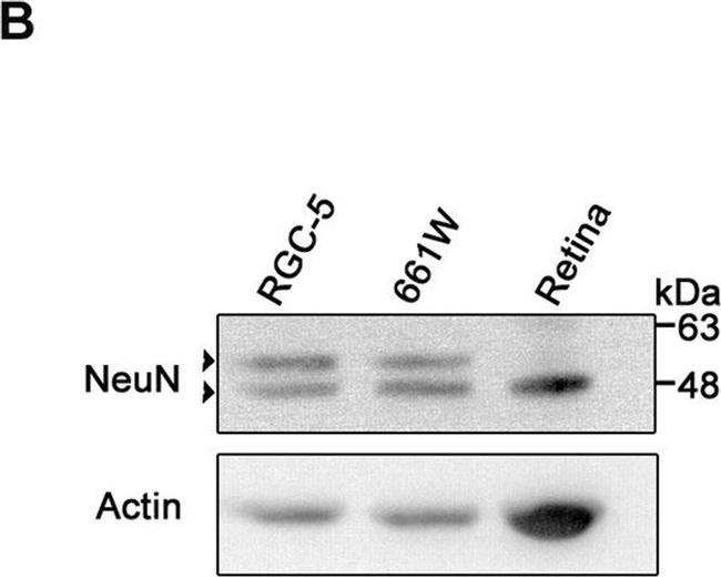 Rat IgG (H+L) Secondary Antibody in Western Blot (WB)