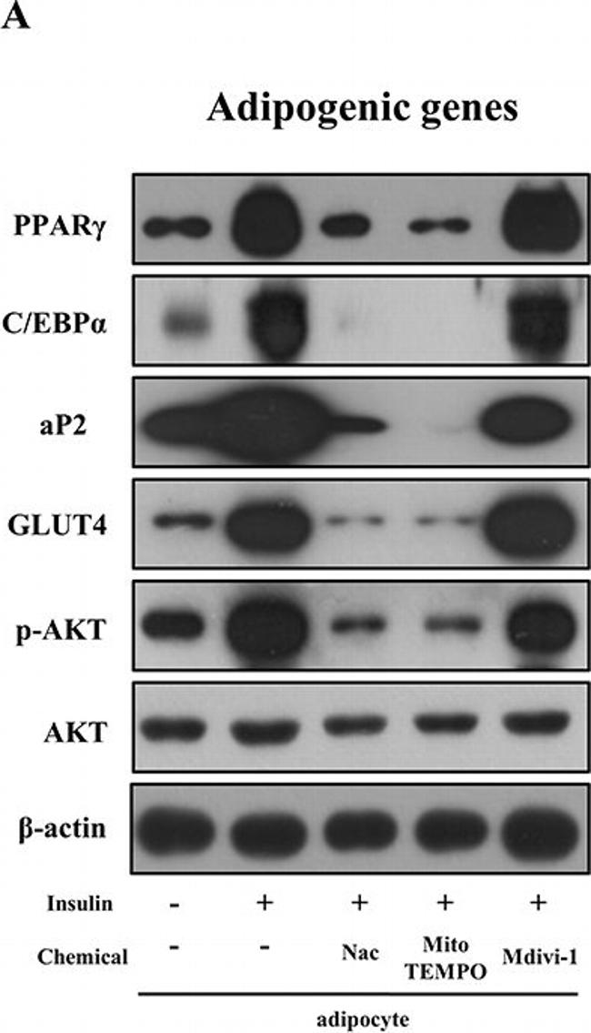 Rabbit IgG (H+L) Secondary Antibody in Western Blot (WB)