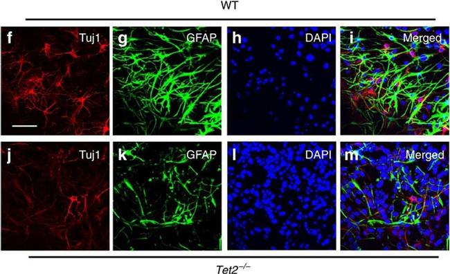 Mouse IgG (H+L) Cross-Adsorbed Secondary Antibody in Immunocytochemistry (ICC/IF)