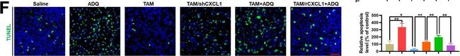 Mouse IgG (H+L) Cross-Adsorbed Secondary Antibody in Immunohistochemistry (IHC)