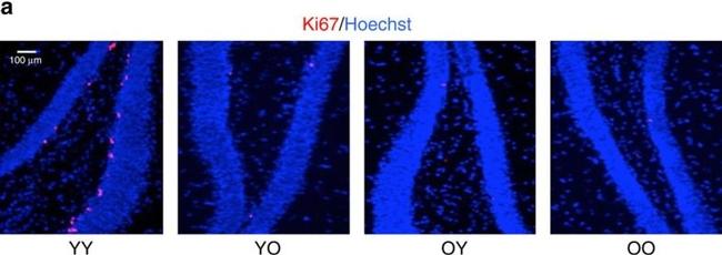 Rabbit IgG (H+L) Cross-Adsorbed Secondary Antibody in Immunohistochemistry (IHC)