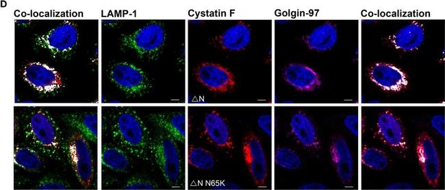 Mouse IgG (H+L) Highly Cross-Adsorbed Secondary Antibody in Immunocytochemistry (ICC/IF)