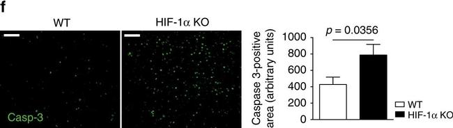 Rabbit IgG (H+L) Cross-Adsorbed Secondary Antibody in Immunohistochemistry (Paraffin) (IHC (P))