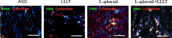 Rabbit IgG (H+L) Cross-Adsorbed Secondary Antibody in Immunocytochemistry (ICC/IF)