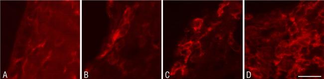 Rabbit IgG (H+L) Highly Cross-Adsorbed Secondary Antibody in Immunohistochemistry (IHC)