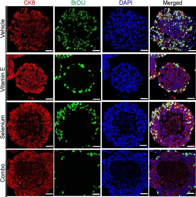 Mouse IgG (H+L) Cross-Adsorbed Secondary Antibody in Immunohistochemistry (IHC)