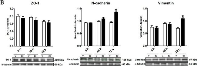 Rabbit IgG (H+L) Secondary Antibody in Western Blot (WB)