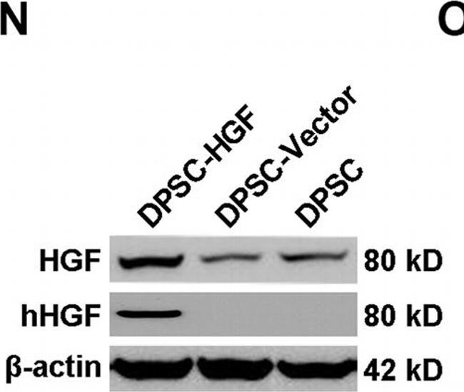 Rabbit IgG (H+L) Secondary Antibody in Western Blot (WB)