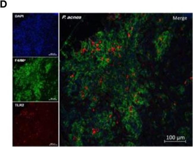 Rat IgG (H+L) Cross-Adsorbed Secondary Antibody in Immunohistochemistry (IHC)