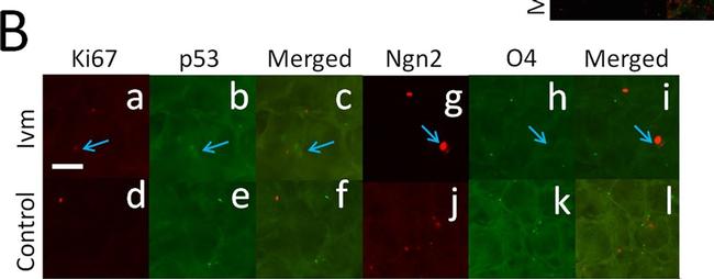 Mouse IgG (H+L) Cross-Adsorbed Secondary Antibody in Immunocytochemistry (ICC/IF)