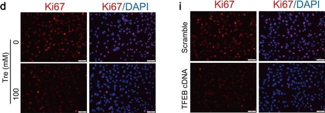 Mouse IgG (H+L) Highly Cross-Adsorbed Secondary Antibody in Immunocytochemistry (ICC/IF)