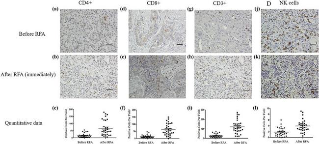 CD8a Antibody in Immunohistochemistry (IHC)