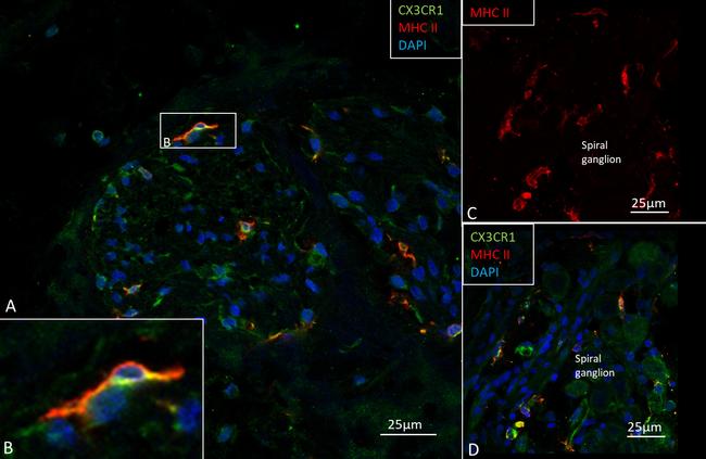 CX3CR1 Antibody in Immunohistochemistry (IHC)