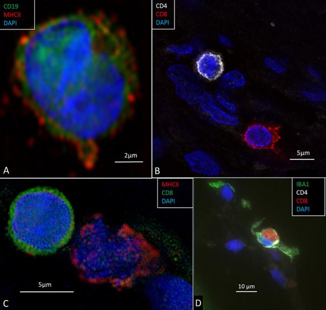 CD19 Antibody in Immunohistochemistry (IHC)