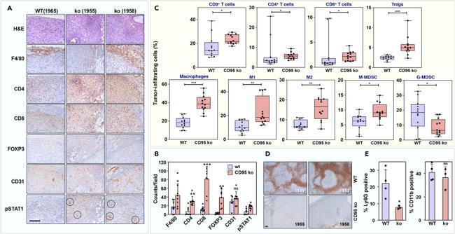 FOXP3 Antibody in Immunohistochemistry (IHC)