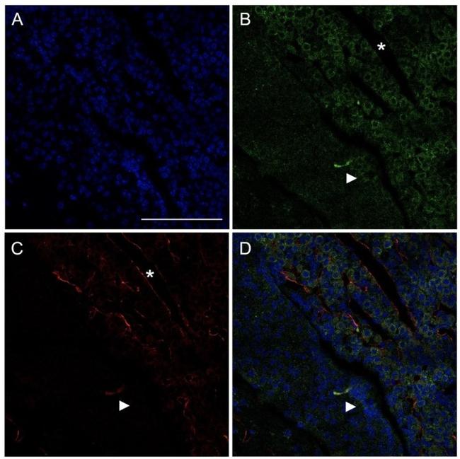 LYVE1 Antibody in Immunohistochemistry (IHC)