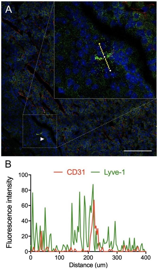 LYVE1 Antibody in Immunohistochemistry (IHC)