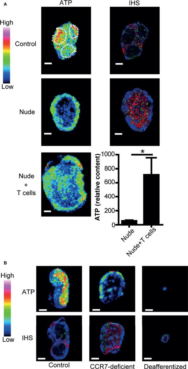 LYVE1 Antibody in Immunohistochemistry (IHC)