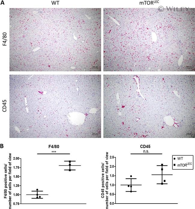 CD45 Antibody in Immunohistochemistry (IHC)