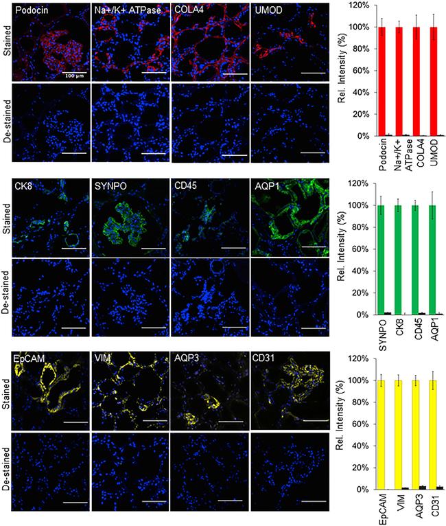 Cytokeratin 8 Antibody in Immunohistochemistry (IHC)