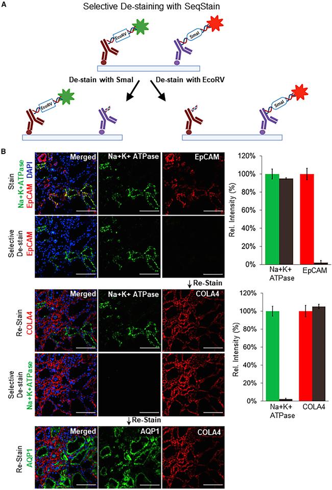 Collagen IV Antibody in Immunohistochemistry (IHC)