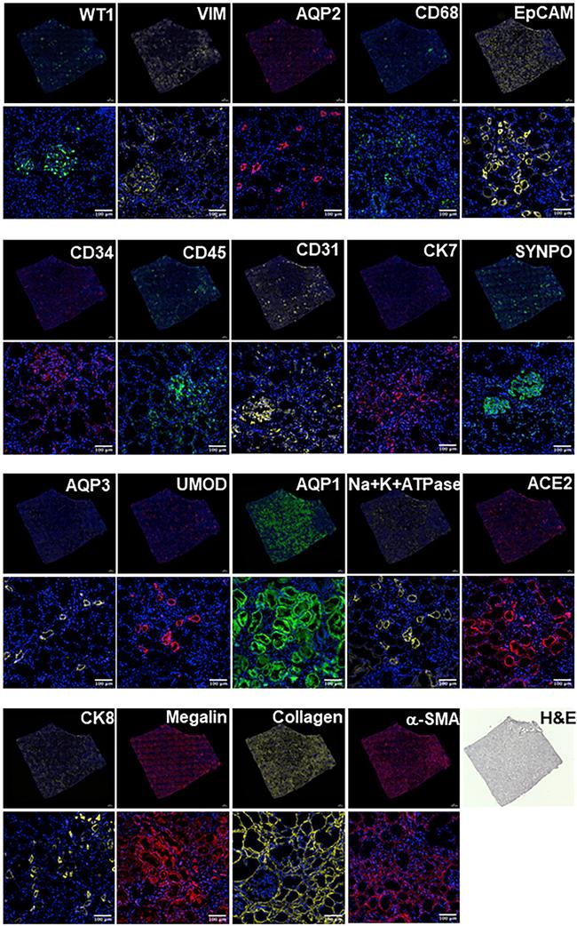 Cytokeratin 8 Antibody in Immunohistochemistry (IHC)