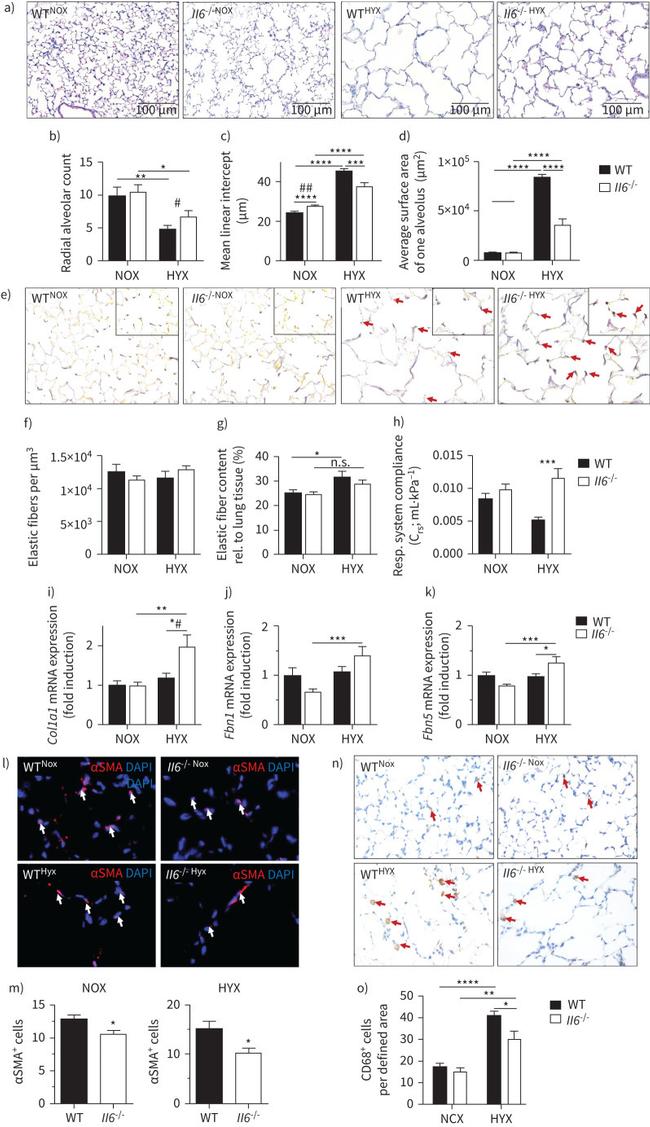 CD68 Antibody in Immunohistochemistry (IHC)