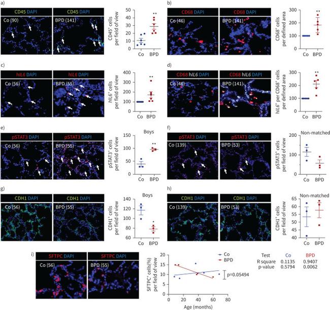 CD68 Antibody in Immunohistochemistry (IHC)