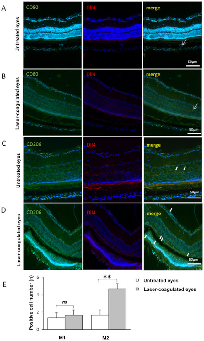 DLL4 Antibody in Immunohistochemistry (IHC)