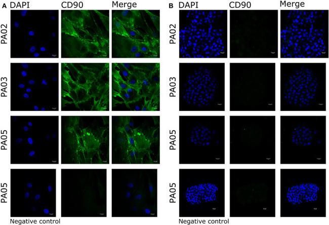 CD90.1 (Thy-1.1) Antibody in Immunocytochemistry (ICC/IF)