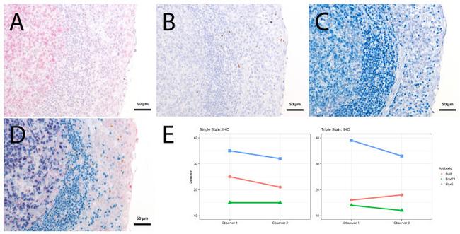 FOXP3 Antibody in Immunohistochemistry (IHC)