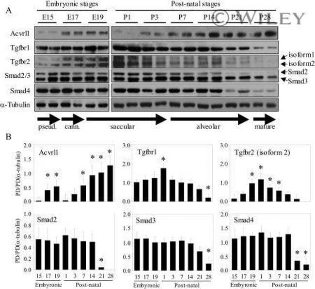 SMAD2 Antibody in Western Blot (WB)