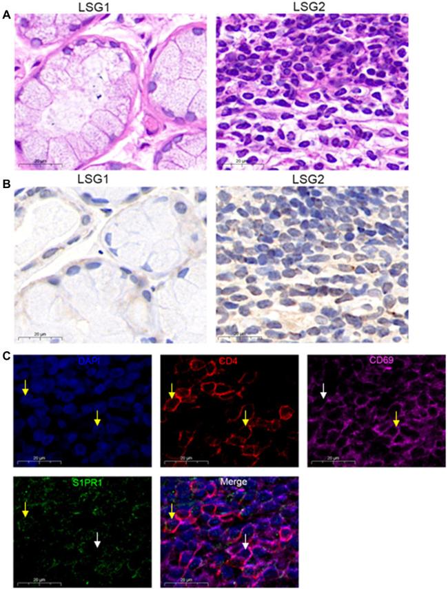 CD4 Antibody in Immunocytochemistry, Immunohistochemistry (ICC/IF, IHC)