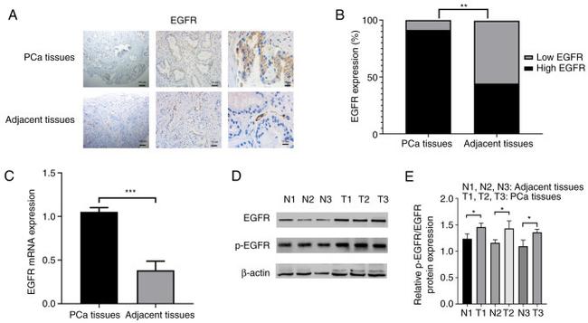 EGFR Antibody in Western Blot, Immunohistochemistry (WB, IHC)