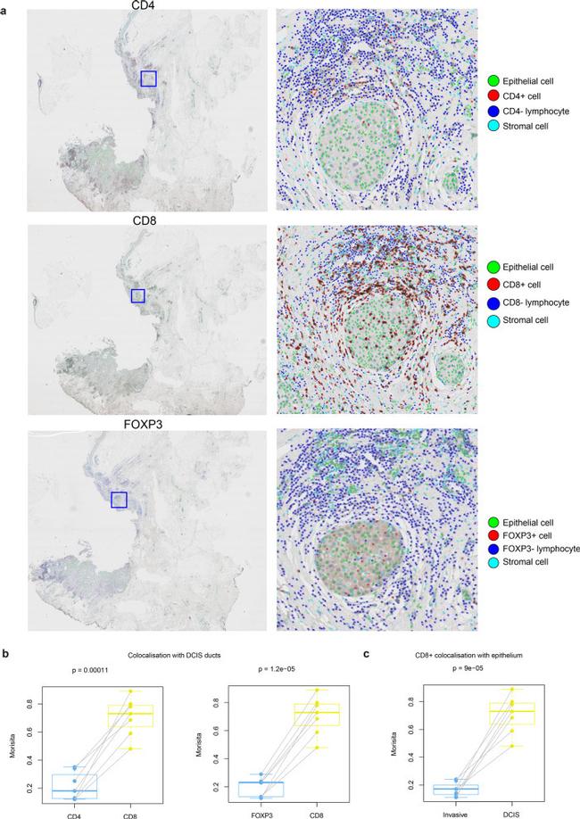 FOXP3 Antibody in Immunohistochemistry (IHC)