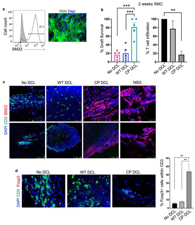 FOXP3 Antibody in Immunohistochemistry (IHC)