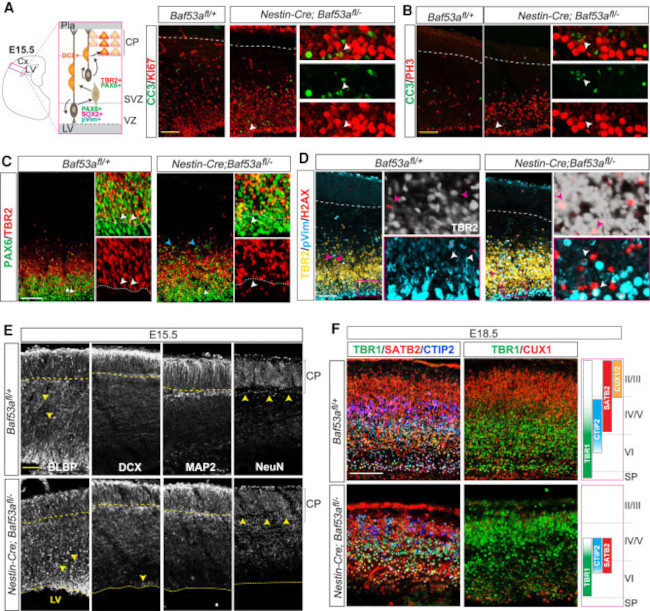 EOMES Antibody in Immunohistochemistry (IHC)