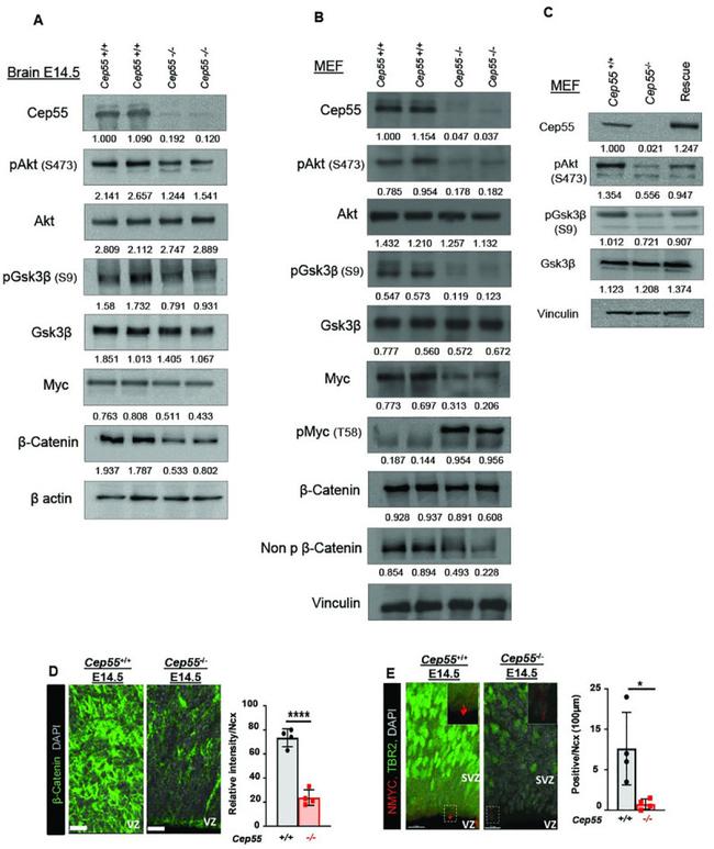 EOMES Antibody in Immunocytochemistry (ICC/IF)